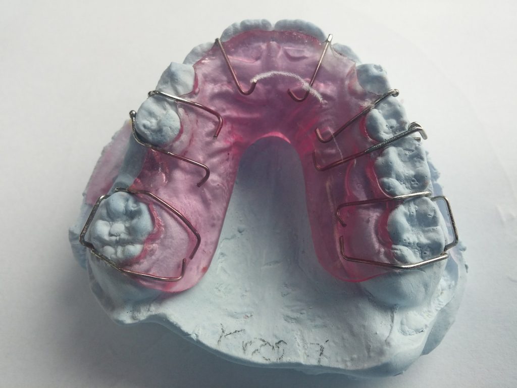 Zahnspange teilweise unnötig - auch schädlich