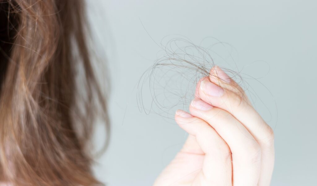 Haarausfall Arten Ursachen Behandlung